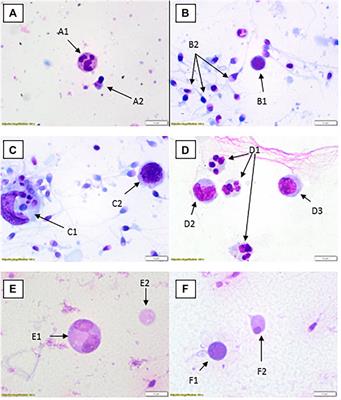 Round Cells in Diagnostic Semen Analysis: A Guide for Laboratories and Clinicians